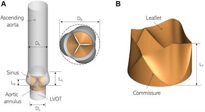 Detecting Aortic Valve Anomaly From Induced Murmurs: Insights From Computational Hemodynamic Models